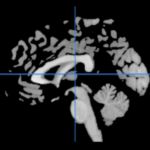 MRI viewer操作畫面